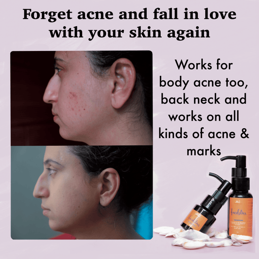 Melange Facebliss reduces acne marks and brightens skin with saffron oil