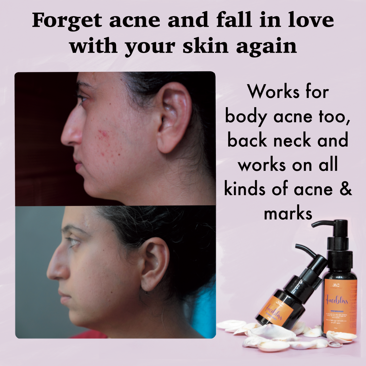Melange Facebliss reduces acne marks and brightens skin with saffron oil