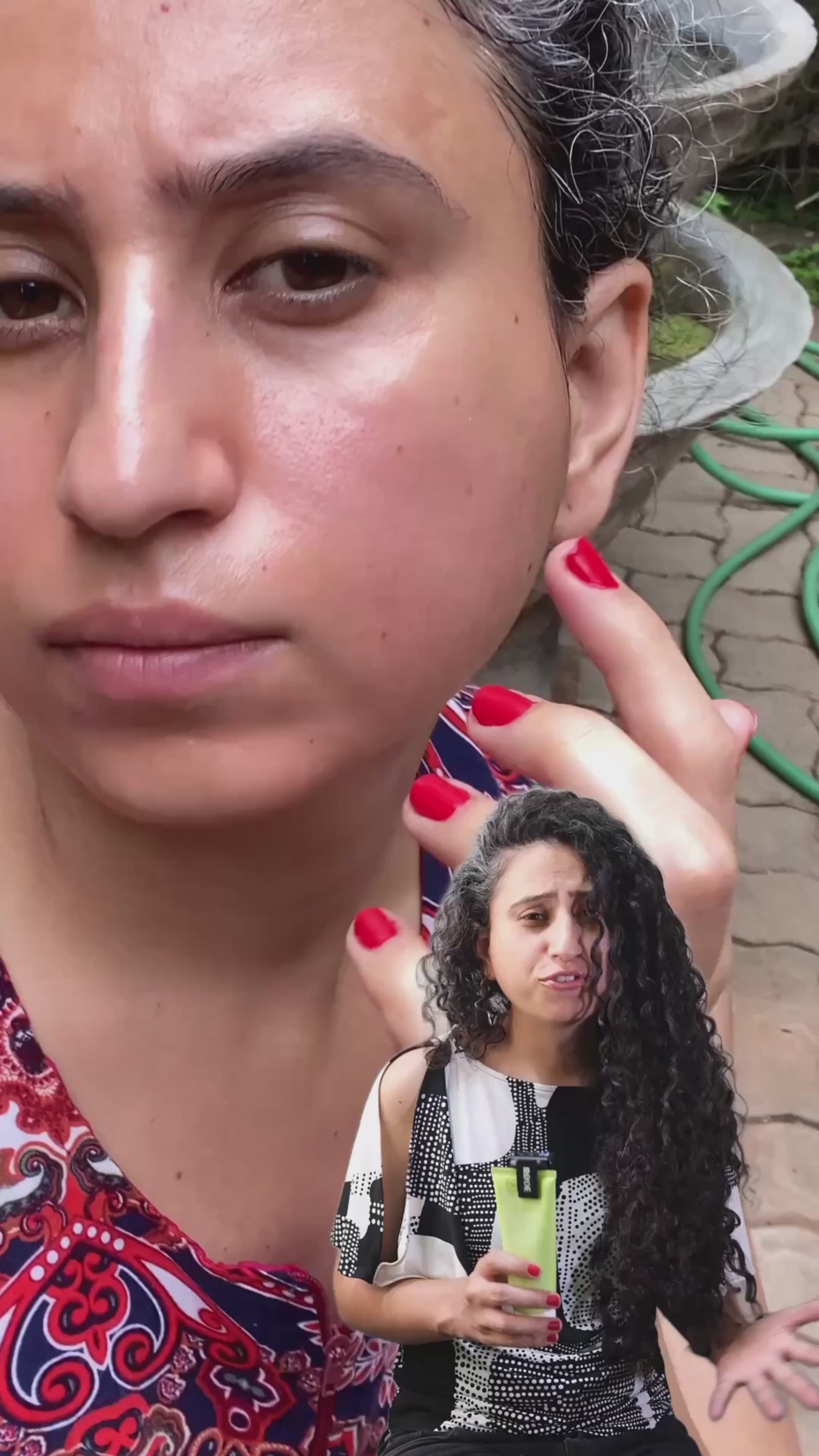 Melange Aloe Vera Gel – how it healed irritated and sensitive skin naturally